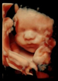 Baby Ultra Sound